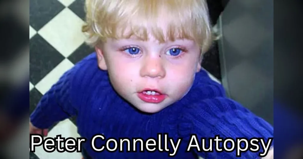 Peter Connelly Autopsy - Information Regarding the Heartbreaking Case ...