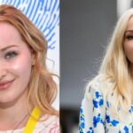 Dove Cameron Before Plastic Surgery