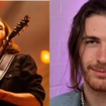 Hozier Nose Surgery