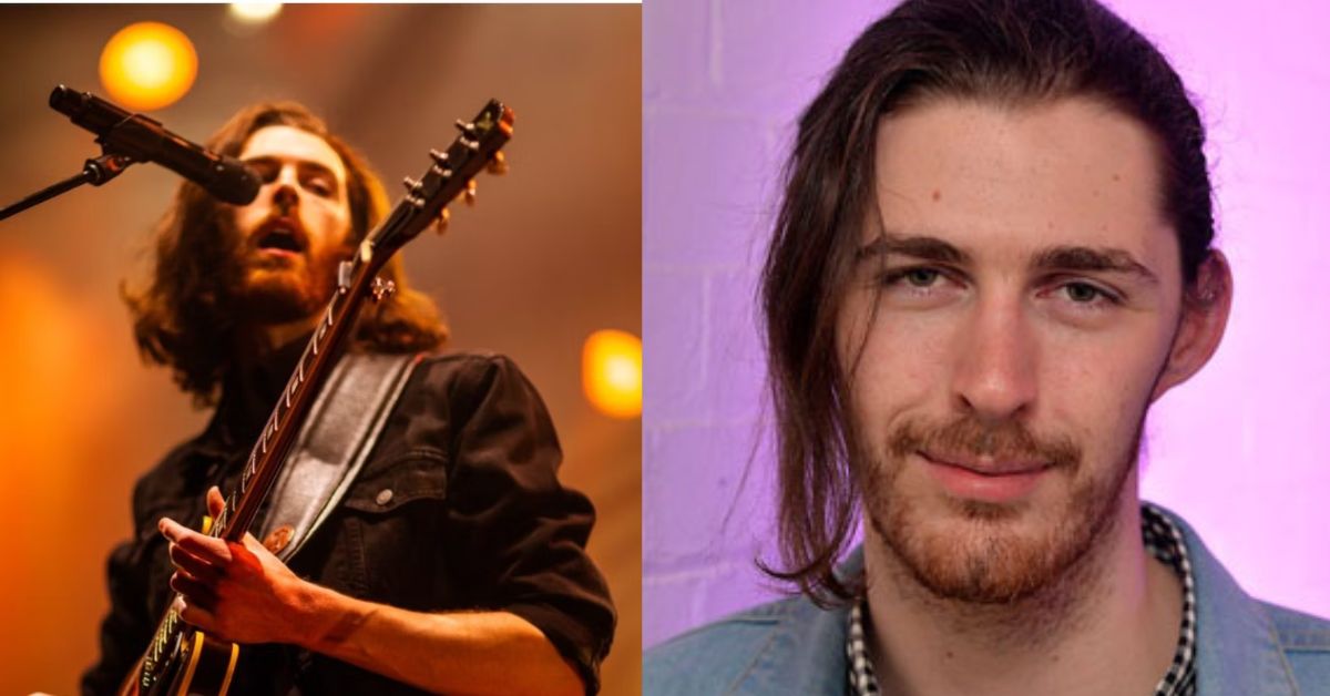 Hozier Nose Surgery