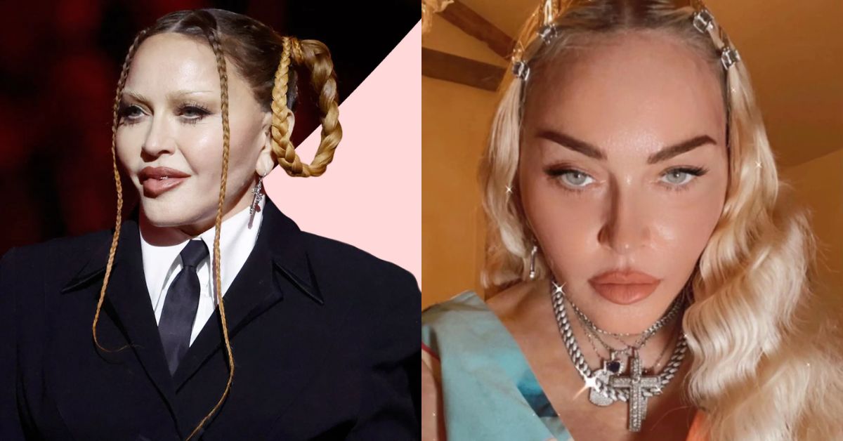 Madonna Plastic Surgery