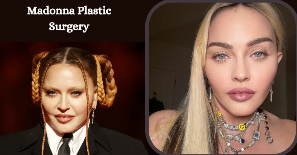 Madonna Plastic Surgery