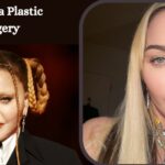 Madonna Plastic Surgery